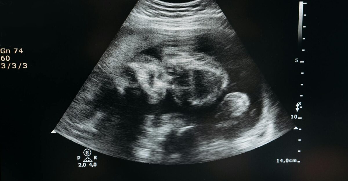 Ultrasound scan showing the image of an unborn child in the womb highlighting pregnancy and healthcare