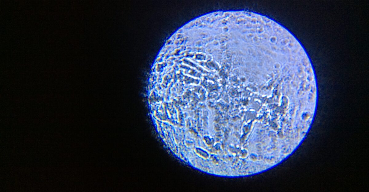 Microbial microorganisms bacterium found on the lens of a microscope from Explore Scientific Explore One