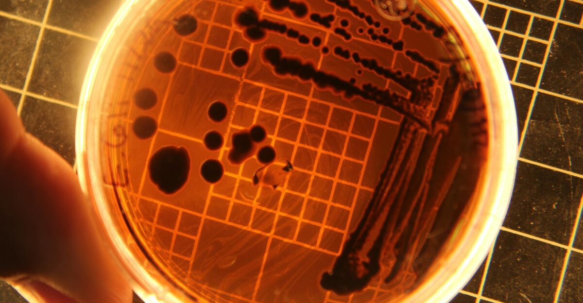Close-up of bacteria colonies in a petri dish under laboratory conditions