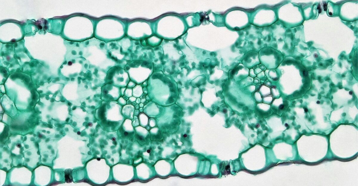 Listeria monocytogenes